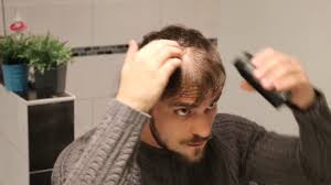 Plus besoin de vous préoccuper de votre coupe de cheveux. Hairvisual Astuce Pour Cacher Une Calvitie Precoce Homme Femme Youtube