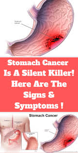 The signs and symptoms can vary greatly from one person to another. Al03xnbokqccrm
