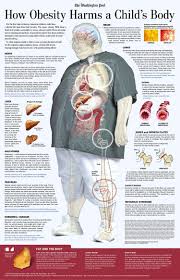 This Is Visual Journalism 56 Visualoop Obesity Awareness Child Obesity Childhood Obesity