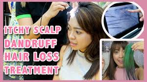 Find special offers and a salon near you! Treatment For Itchy Scalp Dandruff And Hair Loss At Heads Salon Gen Zel Habab Youtube