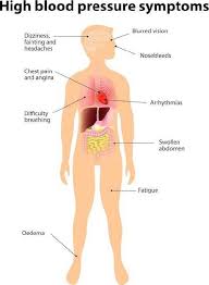 There are no specific symptoms associated with this type of pain, however patients claim that. Hypertensionhainasigns Recherche Sur Twitter
