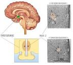 Resultado de imagen para "la bisexualidad" conclusiones "nuevo estudio" "the lancet" "New England Journal of Medicine"