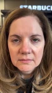 UPDATE: I did some research and learned this can be caused by the  medication oxcarbazepine. And, looked back