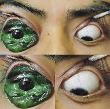 Eye tattoos are famous for their linkage with ancient. A Tattooed Sclera Gone Wrong Botchedsurgeries