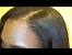 Wax Stick For Hair Removal