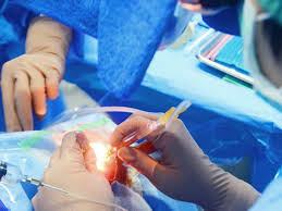 Cataract surgery, vision correction surgery, glaucoma, diabetic retinopathy, oculorplasty including upper lid blepharoplasty, ectropion and entropion repair, eyelid reconstruction; Eye Care Associates Of Nevada Lasik Cataracts Eyelid Procedures Eye Exams Reno Sparks Elko Ely Wiccemucca