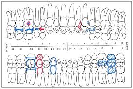 dental charting practice sheets best picture of chart