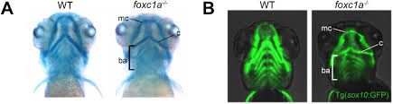 The Axenfeld-Rieger syndrome gene FOXC1 contributes to left-right  patterning