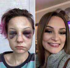 Recovery is possible with the right support