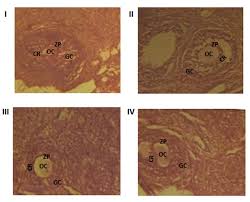 Image result for Hippocratea africana