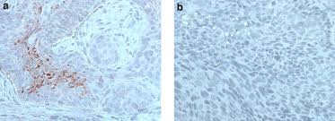 Image result for Treponema