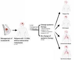 If breast cancer comes back regionally, it means that the cancer has returned to the lymph nodes or near to the original cancer but not exactly the same place. Outcomes Of Changing Systemic Therapy In Patients With Relapsed Breast Cancer And 1 To 3 Brain Metastases Npj Breast Cancer