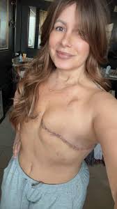 Finally an appointment with Dr that will be starting my cancer radiation  and chemo Monday. We will be glad to fight it.