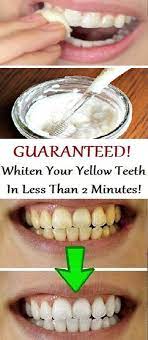 Pin On Health Care Today Tips