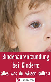 Bindehautentzundung Kleinkind Baby Kind Kleinkind Kinder Bindehautentzundung