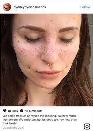 Freckle Tattoos Tattooed Freckles Freckles Face Tattoos