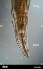 Image result for Pinworm