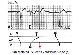 Ecg Learning Center An Introduction To Clinical Electrocardiography Salvos espoo | sales exhibition. ecg learning center an introduction