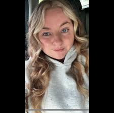 What are good places for microdermabrasion in downtown Kansas City or  northland?