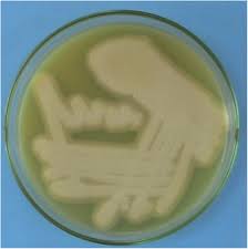 We did not find results for: Occurrence Of Clostridium Perfringens Contamination In Poultry Feed Ingredients Isolation Identification And Its Antibiotic Sensitivity Pattern Sciencedirect