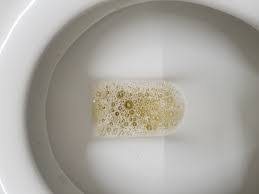 We did not find results for: Why Do I Have Bubbles When I Urinate Quora