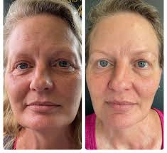 Meet LeKeya Weir, MSN, RN