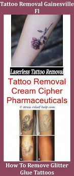 We still recommend the laser tattoo removal method. Excision Tattoo Removal How Much Would It Cost To Remove A Small Tattoo Did Wiz Khalifa Get His Tattoos Remove Tattoo Removal Cost Small Tattoos Tattoo Removal