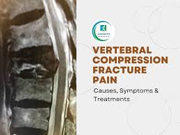 Image result for Vertebral Compression Fracture