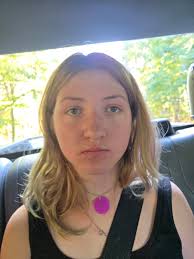 Reaction to crackers with acid reflux