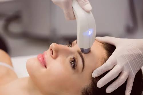 Laser Skin Tightening: What Is It and How Long Does It Last?