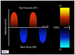 Doppler Color Flow Map Virtual Tee Colour Color Doppler