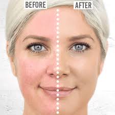 Rosalique Duo-set 3-1 Miracle Formula + Rosalique Brush