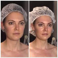 Elite Esthetic Studios