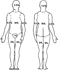 Rule Off Nines Rule Nines Burn Chart Burn Injury Burns