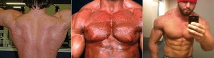 We did not find results for: Winstrol Guide Side Effects Dosage Benefits And Results