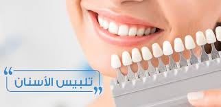 تلبيس الأسنان أو التيجان الصناعية الأسعار وطريقة العلاج المناسبة تركي ويز