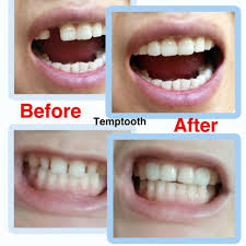 Look through examples of gigi palsu translation in sentences, listen to pronunciation and learn karena gigi palsu tidak terpancang sebagaimana halnya gigi asli, gigi palsu dapat dengan mudah dicabut. Yealon 30ml Gigi Palsu Gigi Palsu Instant Sarung Gigi Palsu Pelekat Gigi Palsu Oral Hygiene Sarung Original Gigi Palsu Set Gigi Palsu Gam Gigi Palsu Mainan Gigi Palsu Sarung Original Smile Gigi