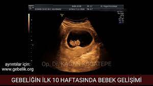4 7 9 ve 10 haftalik gebelikte aciklamali ultrason goruntuleriyle 1 trimester embriyo gelisimi youtube
