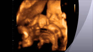 3d Ultrasound 4d Ultrasound New York Ny Nyc Sono Baby Studio