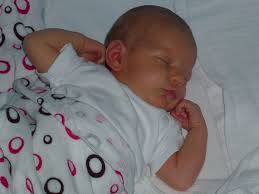 Żółtaczka u noworodków