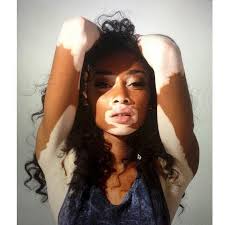 Model Chantelle Winnie Ignores The Critics And Stands Tall Beauty Chantelle Brown Young Chantelle Brown
