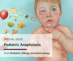 Image result for Anaphylaxis
