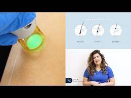 Here at the laser treatment clinic, we use the same laser for hair removal in both women and men, with the levels chosen and adjusted. Laser Hair Removal Videos Pulse Light Clinic London