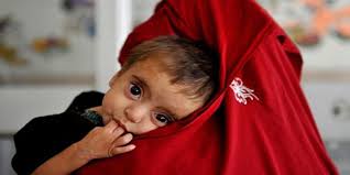 Why Are Nearly Half of Children in Pakistan Stunted?