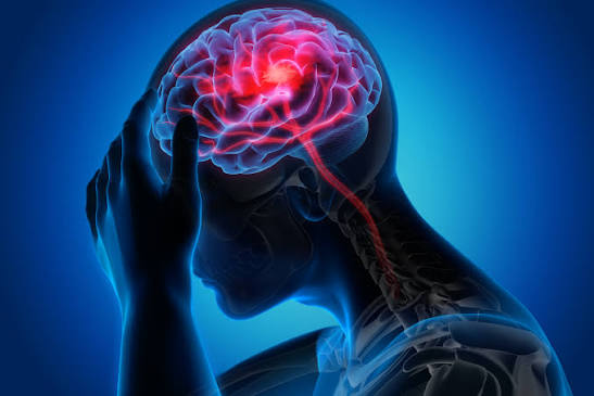 O que é Acidente Vascular Cerebral (AVC), quais os diferentes tipos e  prevenção