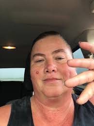 Starting consecutive days running again