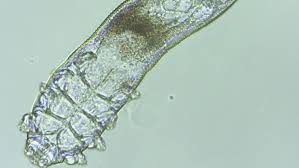 Demodex folliculorum and demodex brevis. Don T Freak Out But There Are Thousands Of Mites Living All Over Your Face Vox