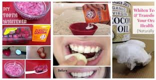 the best homemade remes to whiten
