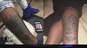 New or worsening symptoms of an existing skin condition, such as psoriasis. Woman Suing Tattoo Shop After Her Tattoo Became Infected