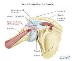 The scapula is a large, flat, and somewhat triangular bone that sits between the humerus. Biceps Tendonitis Of The Shoulder Rehab My Patient Bicep Tendonitis Tendinitis Shoulder Rehab